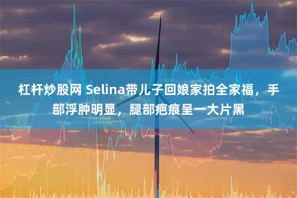 杠杆炒股网 Selina带儿子回娘家拍全家福，手部浮肿明显，腿部疤痕呈一大片黑